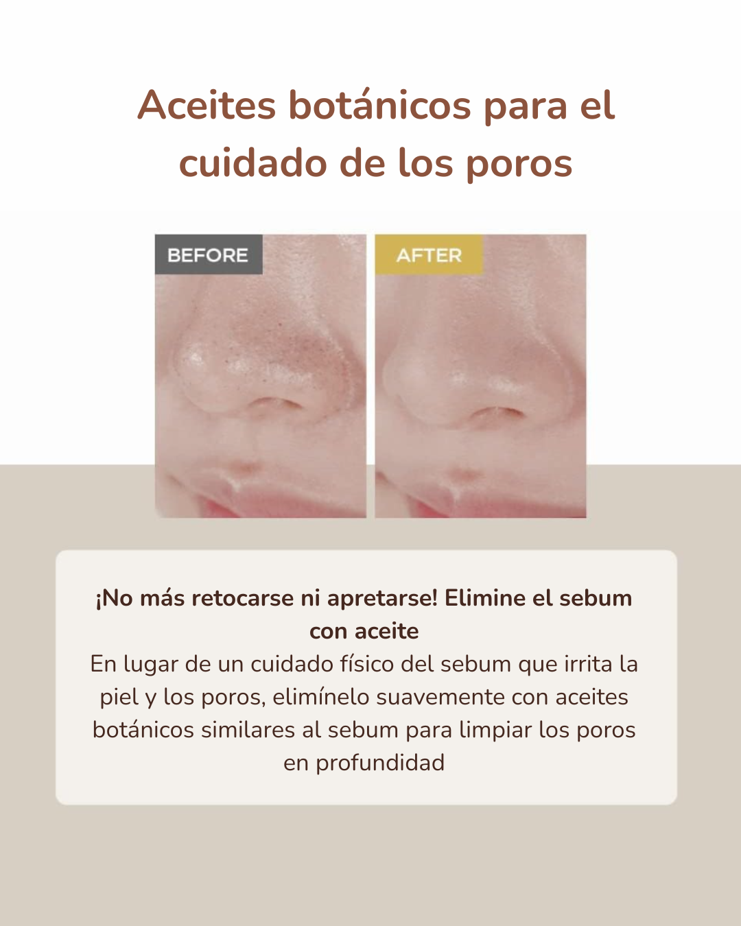 Skin1004 Aceite Limpiador Madagascar Centella Light Cleansing Oil
