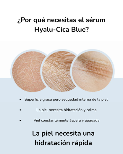 SKIN1004 Madagascar Centella Hyalu-Cica Blue Serum